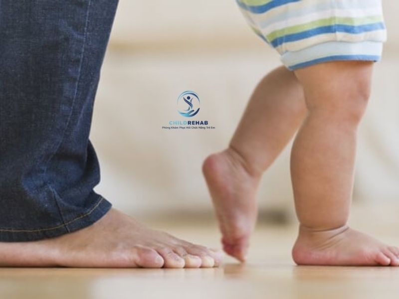 Bài Tập Cho Trẻ Bị Chân Chữ O Hỗ Trợ Tư Thế Và Dáng Đi 2026 | ChildRehab