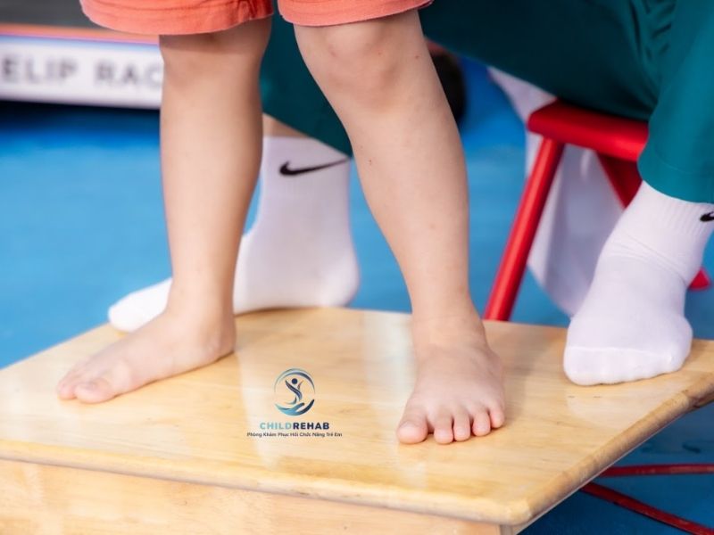 Bài Tập Chân Chữ O Ở Trẻ Có Hiệu Quả Không? 2026 | ChildRehab