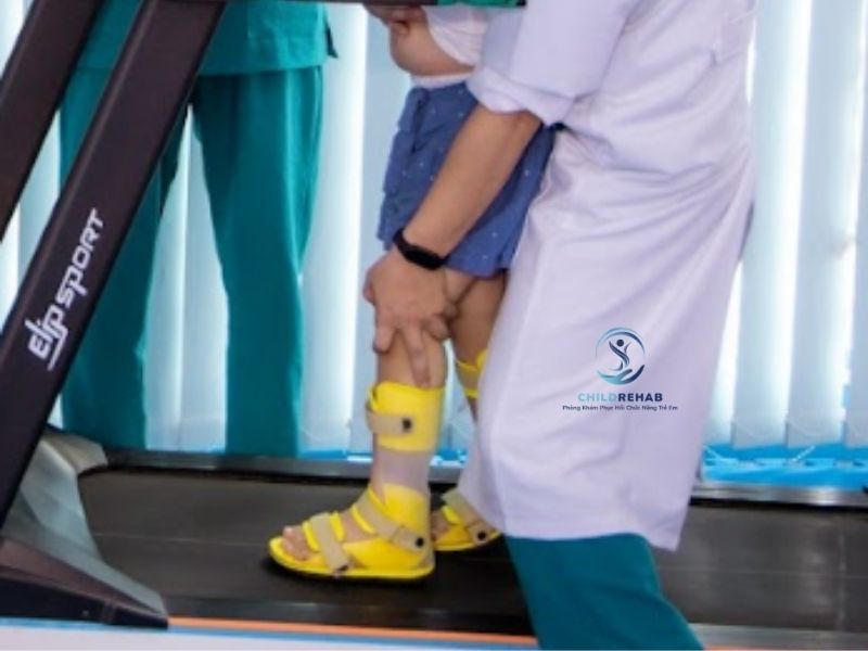 Trẻ Bị Chân Chữ O Có Nên Đeo Nẹp Không? 2026 | ChildRehab