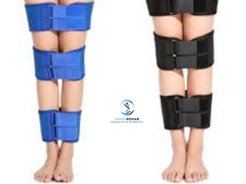 Nẹp Chân Chữ O Cho Trẻ Có Hiệu Quả Không? 2026 | ChildRehab