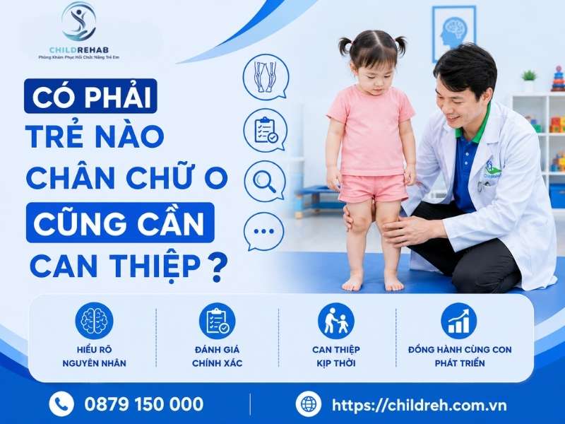 Có Phải Trẻ Nào Chân Chữ O Cũng Cần Can Thiệp? 2026 | ChildRehab