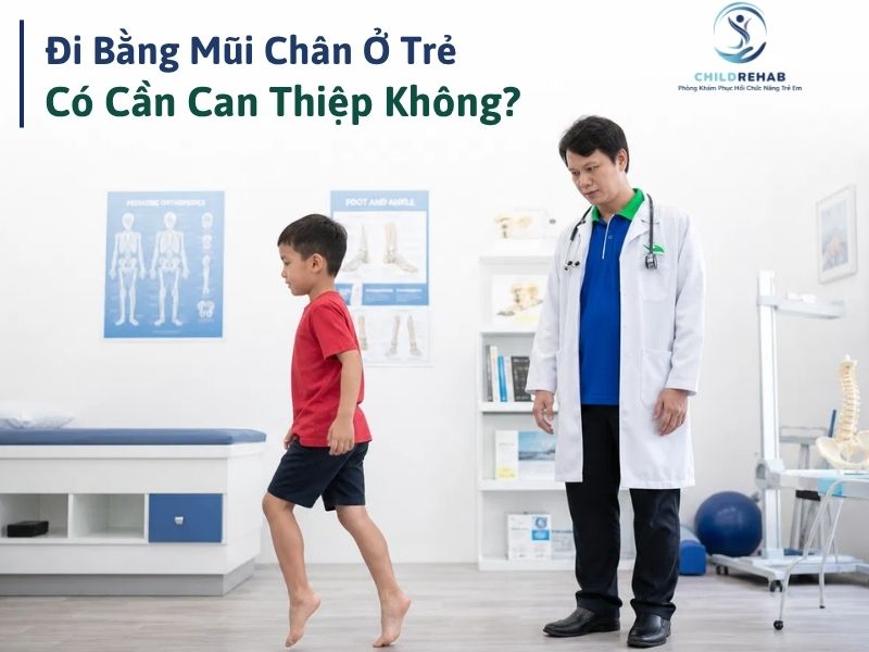 Đi Bằng Mũi Chân Ở Trẻ Có Cần Can Thiệp Không? 2026 | ChildRehab