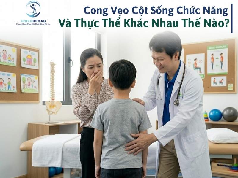 Cong Vẹo Cột Sống Chức Năng Và Thực Thể Khác Nhau Thế Nào? 2026 | ChildRehab