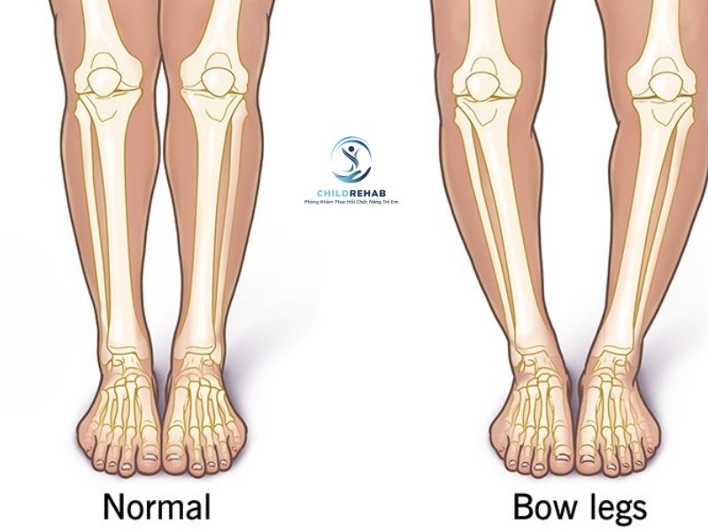 bai-tap-cho-tre-chan-chu-o-tai-nha