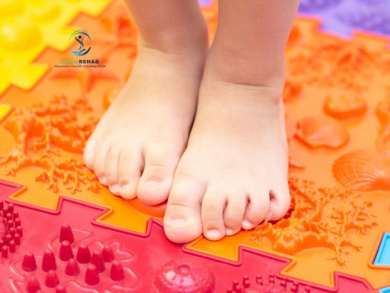 Tìm hiểu mối liên hệ giữa bàn chân bẹt và lệch trục chi dưới ở trẻ.