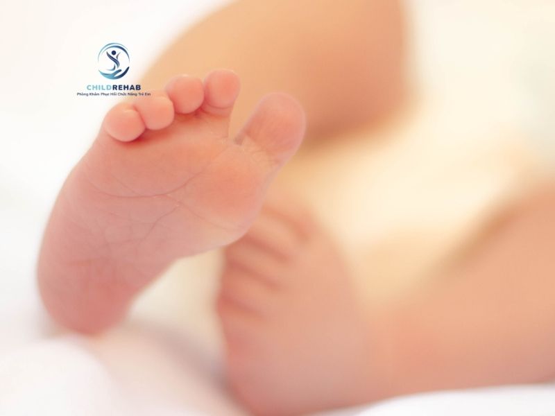 Bàn chân bẹt ở trẻ có liên quan đến yếu tố di truyền hay không.