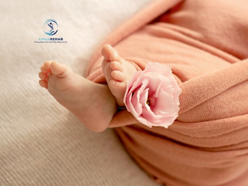  Bàn chân bẹt ở trẻ có thể tự cải thiện theo tuổi hay cần can thiệp sớm.