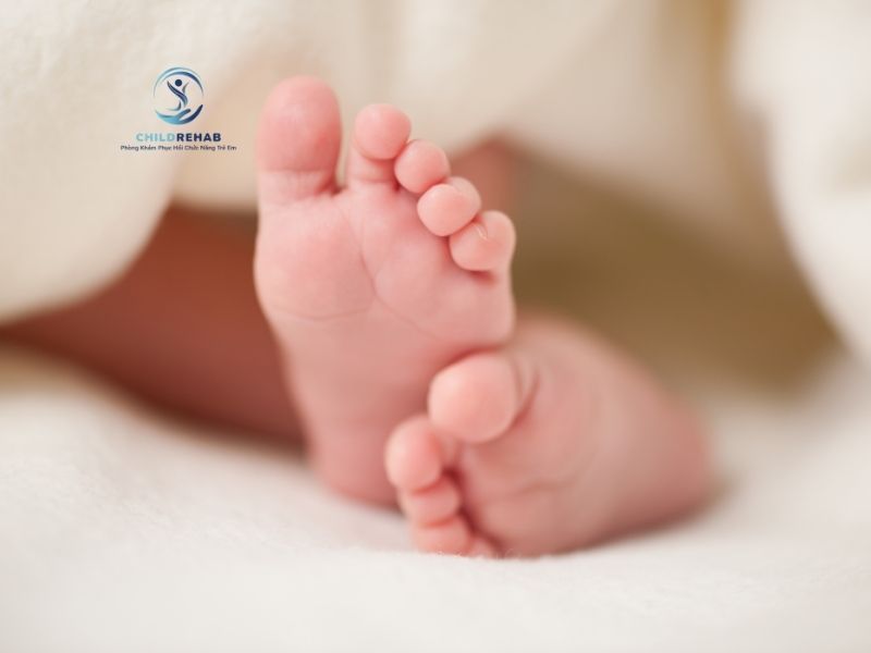 Bàn chân bẹt ở trẻ có thể phát hiện từ khi nào và đâu là thời điểm đánh giá phù hợp.
