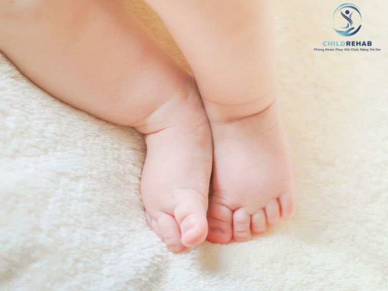Hướng dẫn phụ huynh cách quan sát trục chân của trẻ tại nhà để phát hiện bất thường sớm.