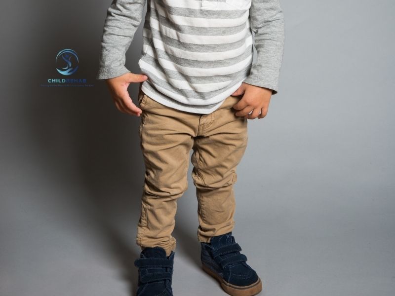 Trẻ 3 tuổi bị chân chữ X có cần can thiệp không.