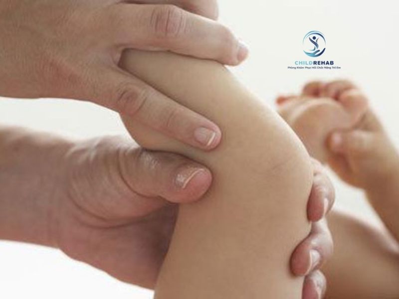 Chân chữ X ở trẻ có thể ảnh hưởng gì đến dáng đứng, dáng đi và hình thể lâu dài.