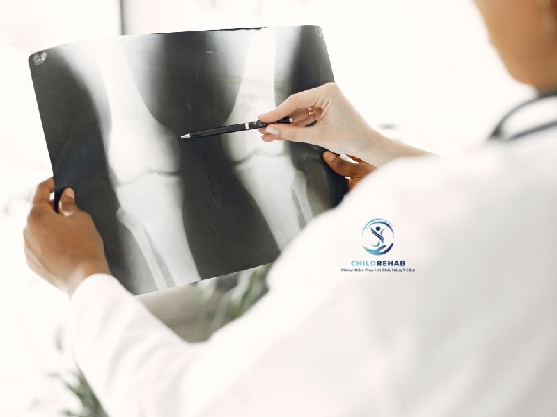 ChildRehab giúp phụ huynh hiểu đúng về các mức độ và chỉ định can thiệp.