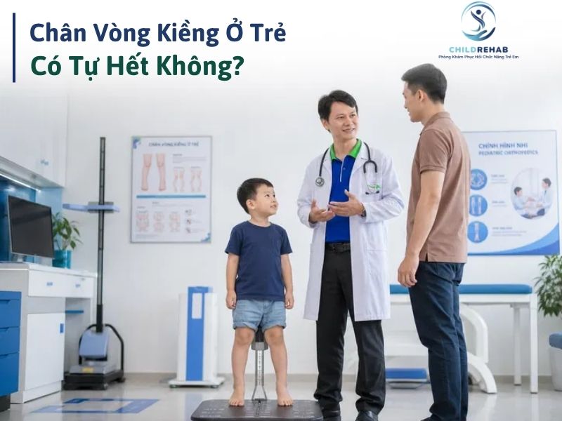 Chân vòng kiềng ở trẻ có tự hết không.