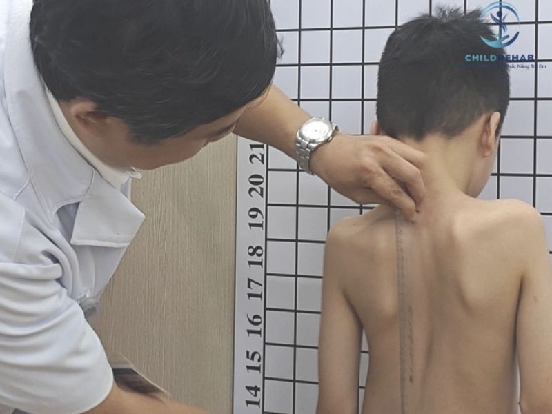 Trẻ 8 tuổi có vai lệch, dáng đứng lệch có thể ảnh hưởng gì đến quá trình học tập và phát triển cơ thể?