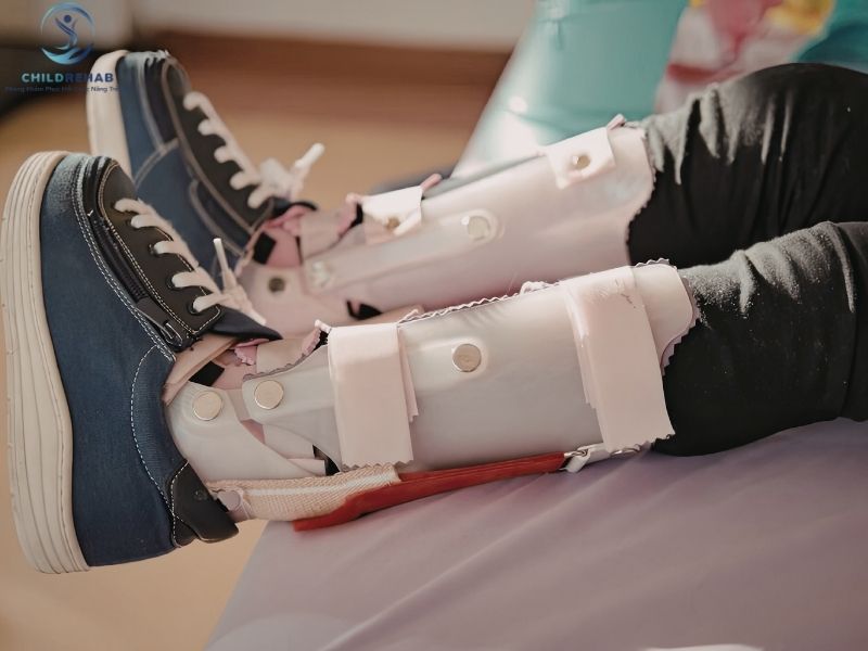 Giày chỉnh hình có giúp cải thiện tình trạng trẻ đi bằng mũi chân không? 