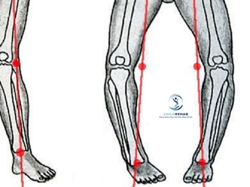 hai-chan-cong-ra-ngoai-co-dang-lo-khong