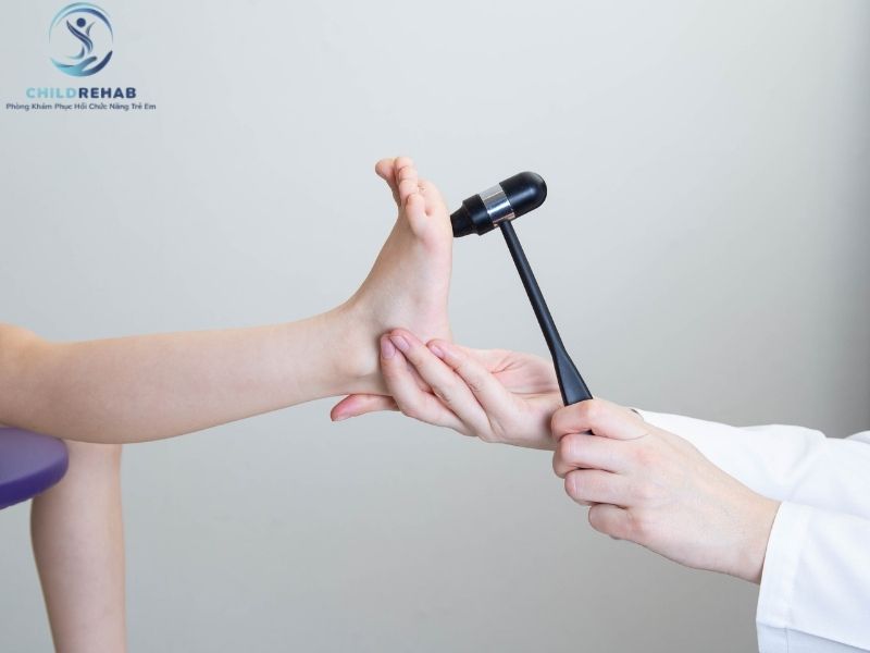 Khi nào trẻ đi bằng mũi chân cần được kiểm tra?