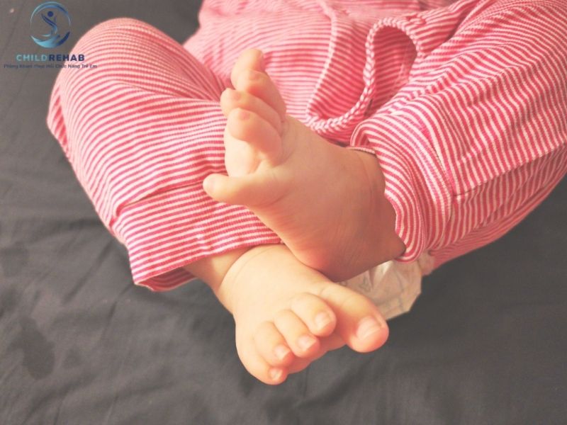 Lệch trục chi dưới và chân chữ X có giống nhau không?