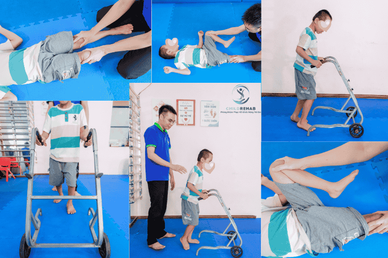 Xây dựng lộ trình vận động trị liệu cá nhân hóa giúp trẻ cải thiện vận động hiệu quả