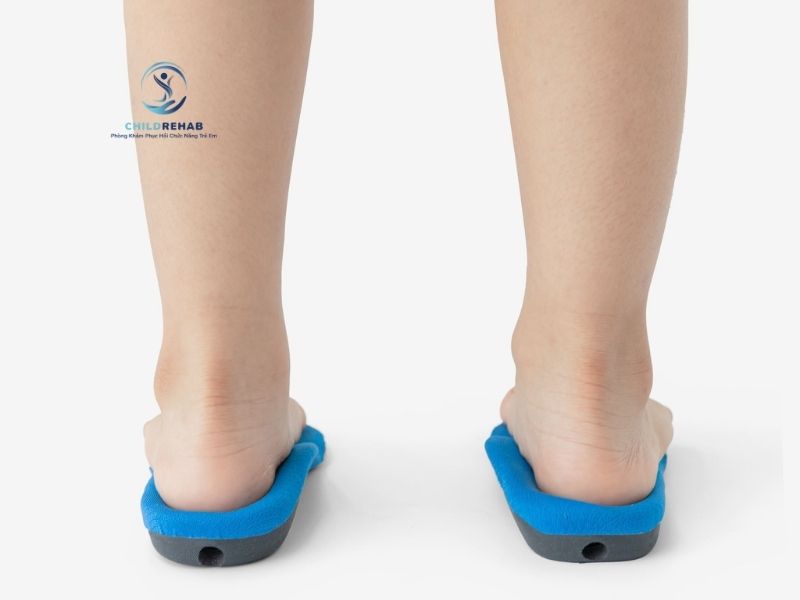 Lót chỉnh hình có vai trò gì trong hỗ trợ tư thế và dáng đi của trẻ bàn chân bẹt.
