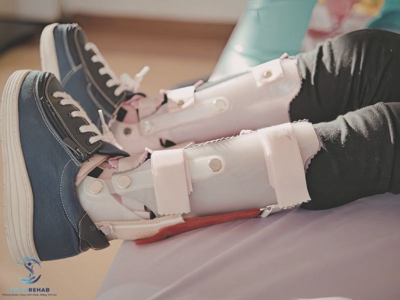 Nẹp chỉnh hình có phải giải pháp phù hợp cho mọi trẻ bị lệch trục chân không?