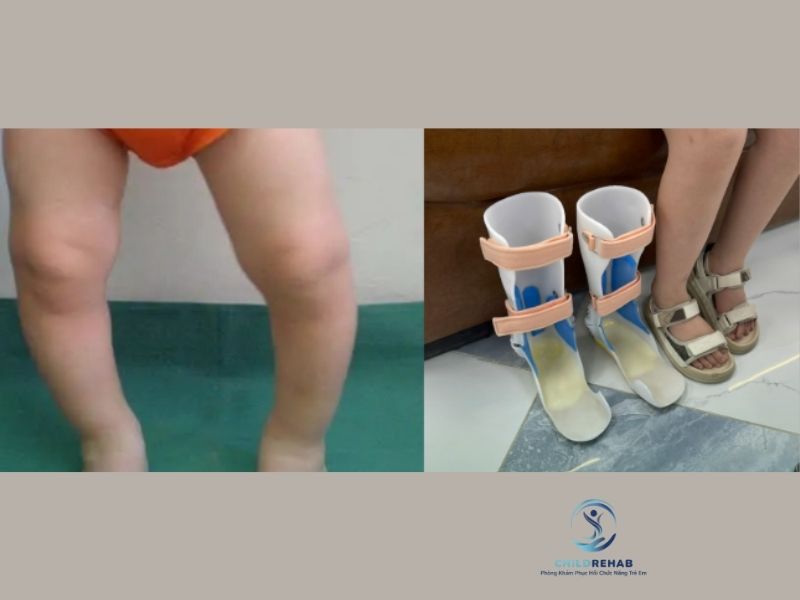 ngoi-sai-tu-the-co-gay-chan-chu-o-khong