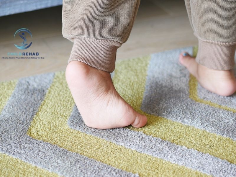 Tìm hiểu các nguyên nhân khiến trẻ đi bằng mũi chân và khi nào phụ huynh nên chú ý theo dõi kỹ hơn.