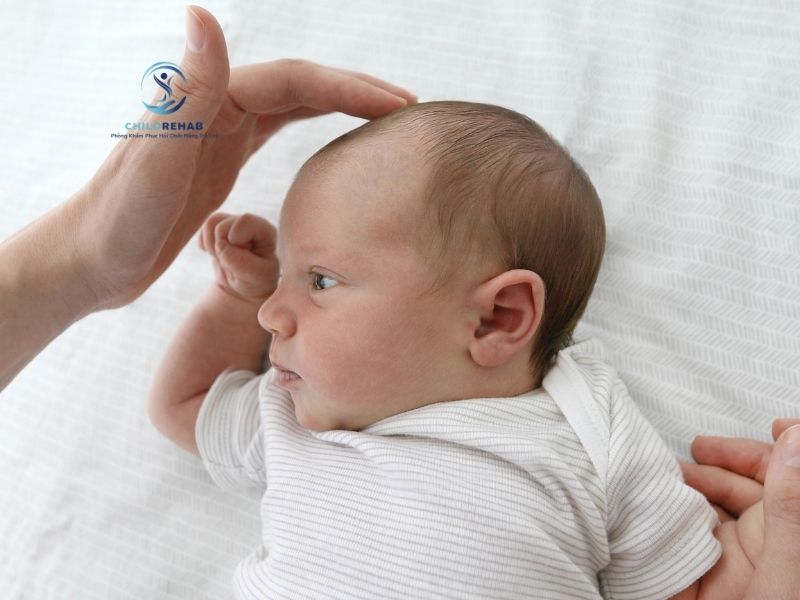 Cách phân biệt vẹo cổ thực sự với tư thế cổ lệch tạm thời ở trẻ nhỏ.