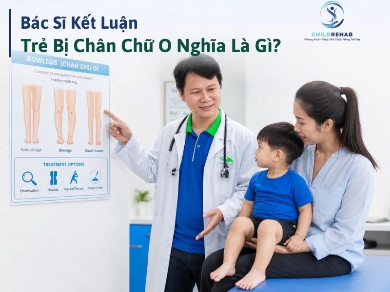 Chân chữ O ở trẻ là gì và ảnh hưởng như thế nào đến vận động.