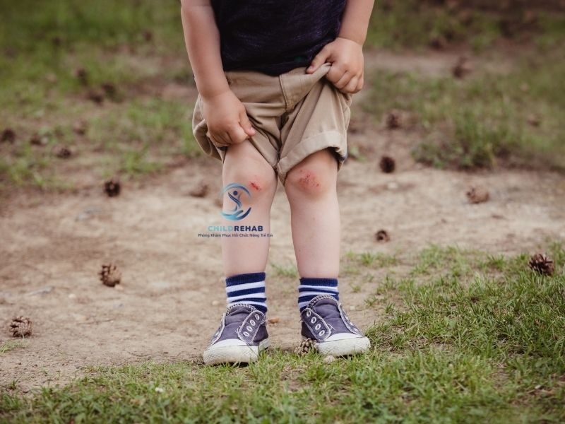 ìm hiểu khi nào là phát triển sinh lý bình thường và khi nào cần đánh giá sớm để tránh ảnh hưởng dáng đi.