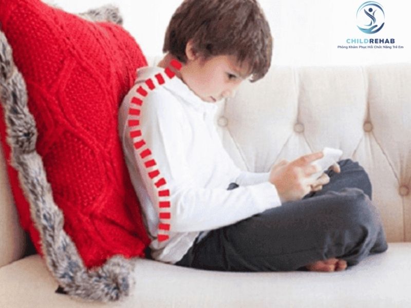 Bé bị gù lưng có đáng lo không?