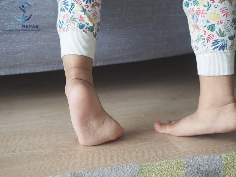 Tìm hiểu trẻ đi bằng mũi chân là gì, khi nào là bình thường, khi nào là dấu hiệu cần đánh giá sớm cùng ChildRehab.