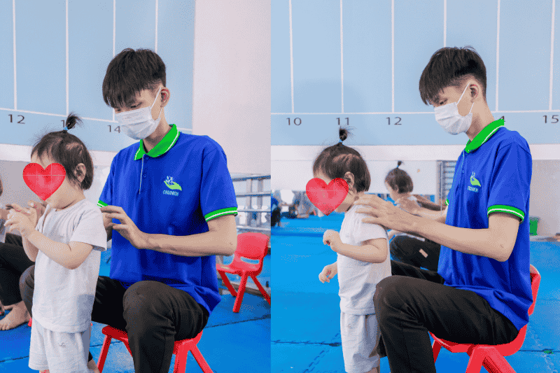 Trẻ gù lưng sớm có thể cải thiện bằng vận động trị liệu nếu can thiệp đúng thời điểm