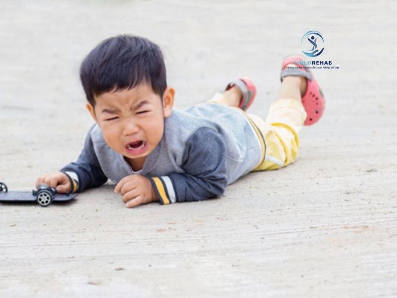 Trẻ hay vấp ngã, chạy không vững có thể liên quan đến chân chữ X hoặc các vấn đề vận động khác.