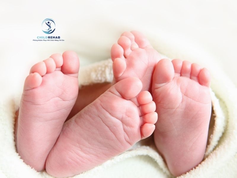 Trẻ sơ sinh có thể bị bàn chân bẹt hay đó chỉ là đặc điểm phát triển bình thường.