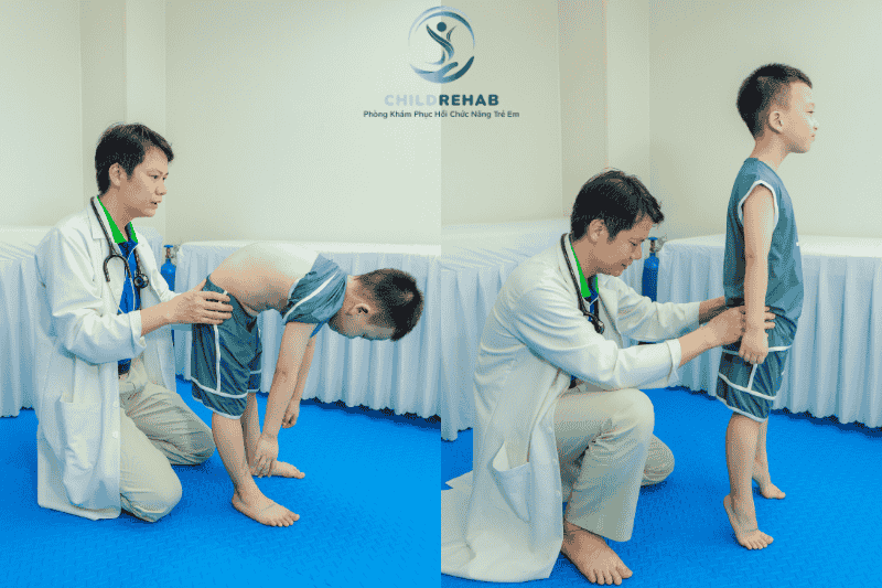 Trẻ cần bao lâu để cải thiện khi can thiệp vận động trị liệu?