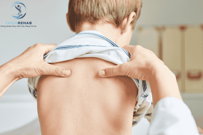 Trẻ tăng trương lực cơ có biểu hiện gì? Vai trò của vận động trị liệu trong cải thiện vận động và tư thế