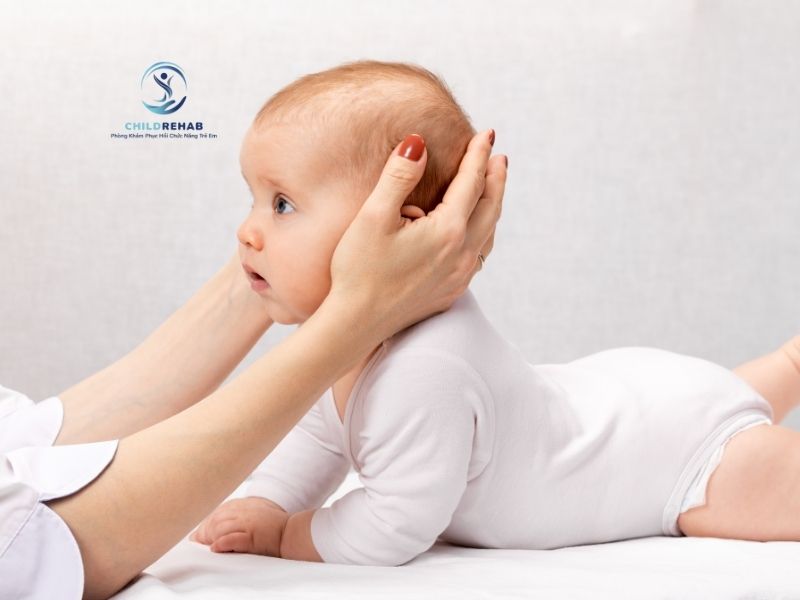 Vẹo cổ ở trẻ có thể ảnh hưởng đến vận động, khuôn mặt và tư thế nếu không can thiệp đúng lúc.
